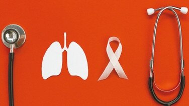 醫療新領域：肺癌的篩查與治療