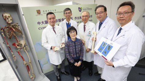 中大醫學院訂立亞洲首個「三維骨質量標準值」有助及早診斷骨質疏鬆及預防骨折