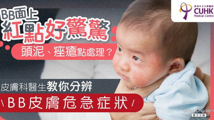新手爸妈要知4大常见皮肤问题 皮肤科医生教分BB皮肤危急症状