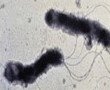 Helicobacter pylori