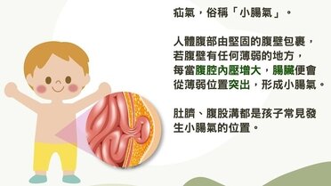 什麼是「腹股溝疝氣」？(Only available in Chinese)