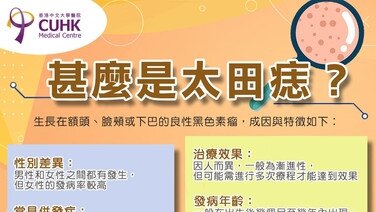 甚麼是太田痣？ (Only available in Chinese)