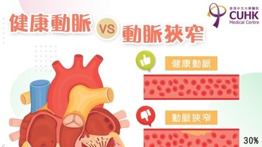 健康動脈 VS 動脈狹窄  (Only available in Chinese)