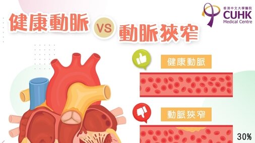 健康动脉 VS 动脉狭窄