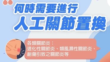 何時需要進行人工關節置換？ (Only available in Chinese)