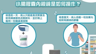 小腸膠囊內視鏡