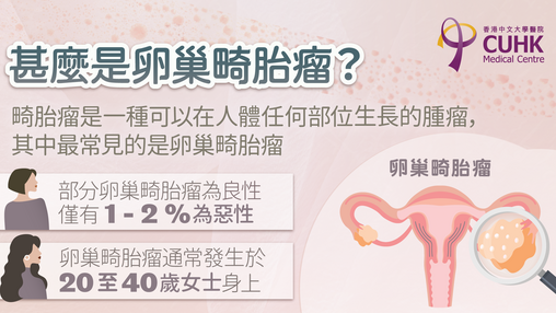 卵巢畸胎瘤 (Only available in Chinese)