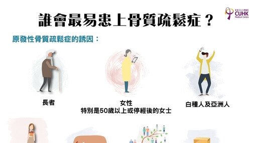 骨質疏鬆你有份？ (Only available in Chinese)