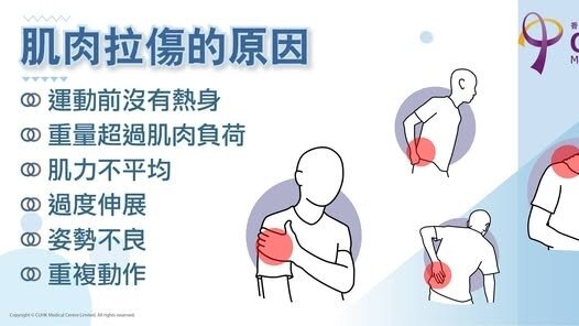 肌肉拉傷