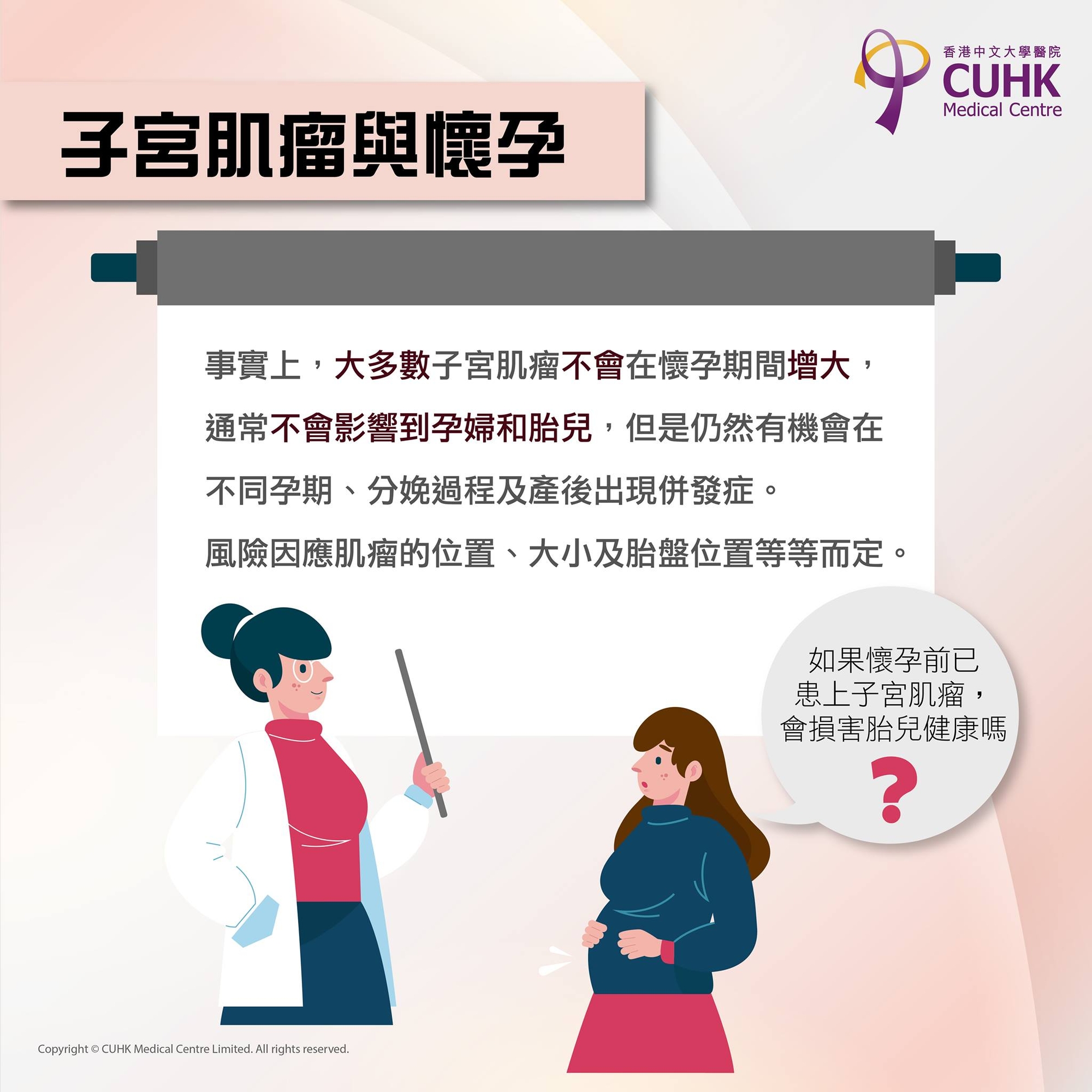 子宮肌瘤