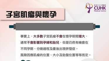 子宮肌瘤與懷孕 (Only available in Chinese)