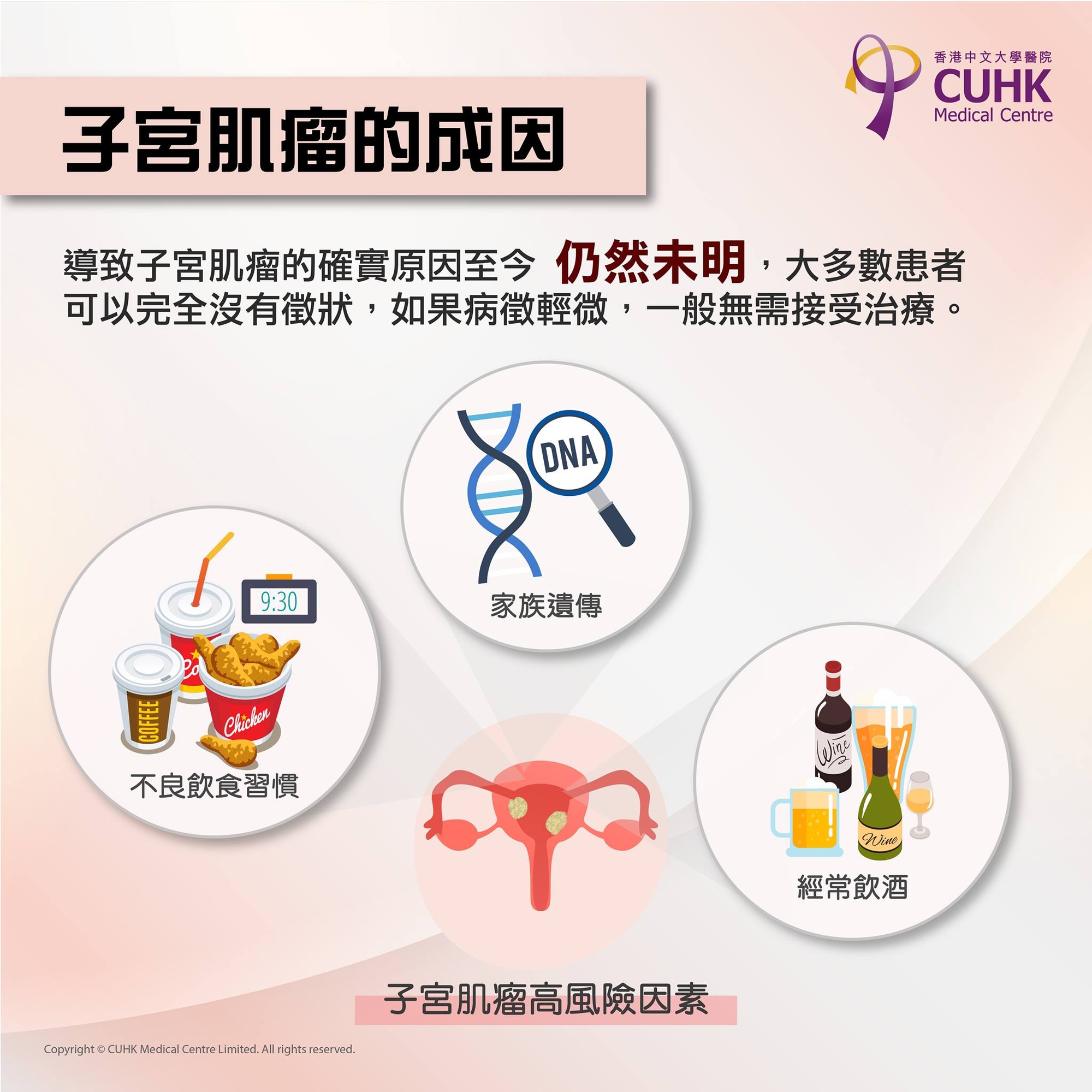 子宮肌瘤