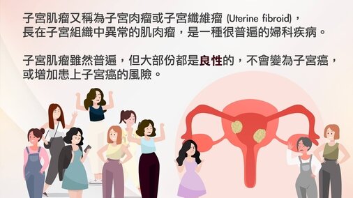 認識子宮肌瘤