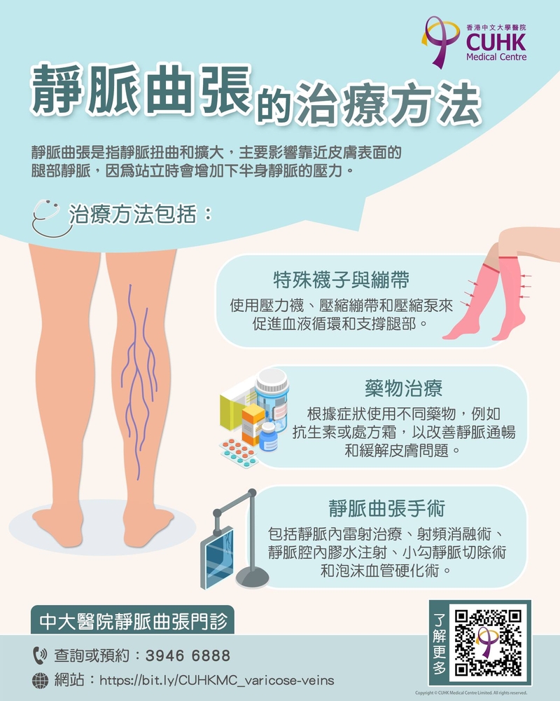 Image of 靜脈曲張治療方法
