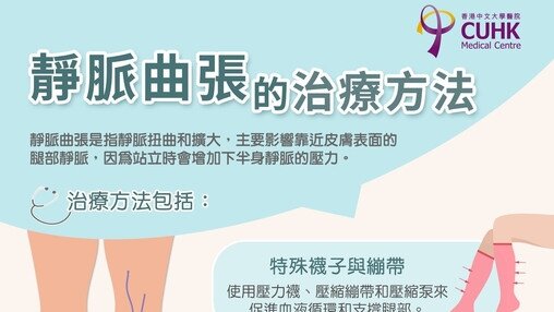 靜脈曲張的治療方法 (Only available in Chinese)