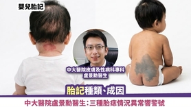 嬰兒胎記丨胎記種類、成因 中大醫院盧景勳醫生：三種胎痣情況異常響警號 (Only available in Chinese)