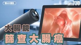 醫sick醫識：大腸鏡 篩查大腸癌