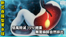 【减肥新招】新式吞服型「胃水球」 低风险减15%体重 无需麻醉自然排出