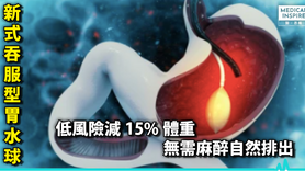 【減肥新招】新式吞服型「胃水球」 低風險減15%體重 無需麻醉自然排出 (Only available in Chinese)