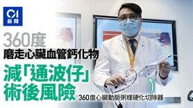 心臟血管鈣化為「通波仔」大敵  新技術可360度磨走鈣化物 (Only available in Chinese)