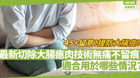 【etnet健康养生】45+留意！大肠瘜肉易变大肠癌？最新切除技术无痛不留痕！适合用于哪些大肠瘜肉情况？