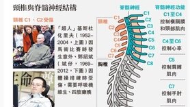 頸椎骨折癱瘓 裝機械腳再起步