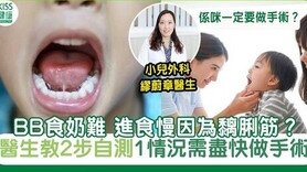 BB食奶难进食慢因为黐脷筋？1情况需尽快做黐脷筋手术