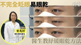 眼乾|眼睛太集中致「不完全眨眼」易眼乾 眼科醫生教完整眨眼+紓緩眼乾法 (Only available in Cantonese)