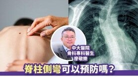 育兒．營養丨脊柱側彎可以預防嗎？骨科專科醫生教簡單檢查方法 (Only available in Chinese)