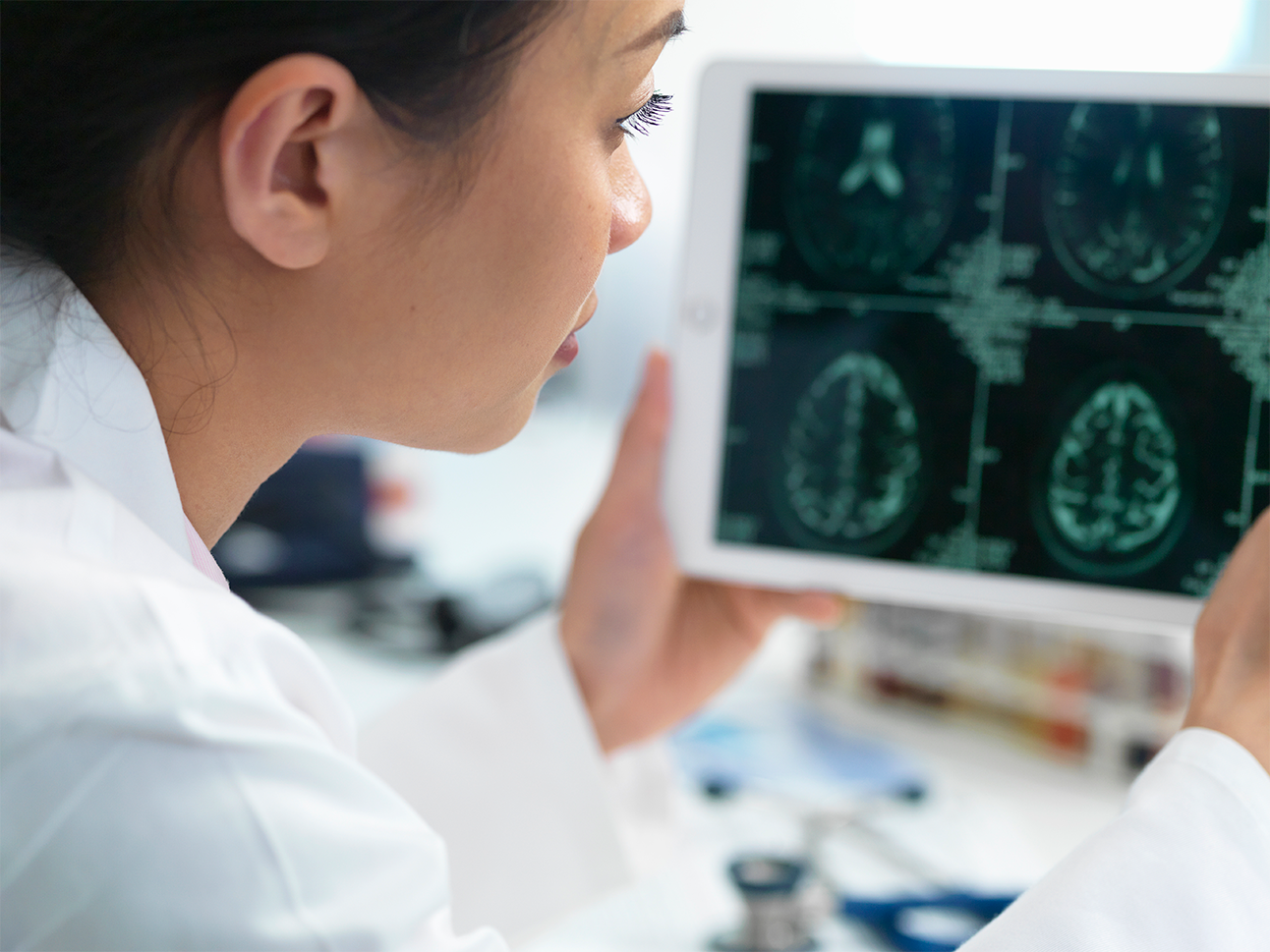 i-Cog Brain Health