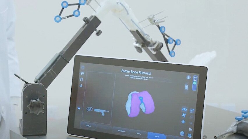 機械人輔助骨科手術