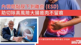 內視鏡黏膜下剝離術(ESD) 助切除高風險大腸瘜肉不留痕 (Only available in Chinese)