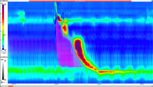 Image of high resolution esophageal impedance manometry